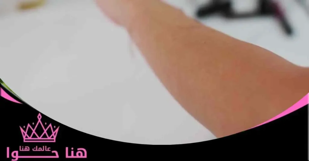 ترطيب البشرة بعد إزالة