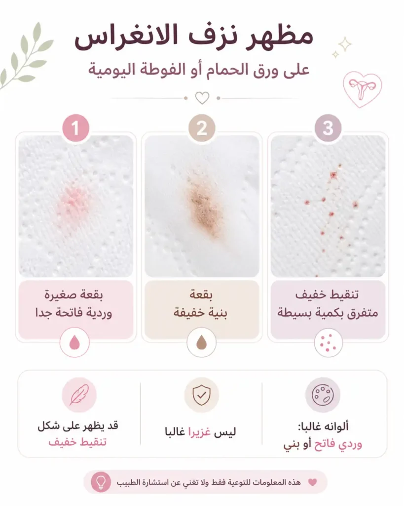ترفش على شكل دم تبويض الغرس