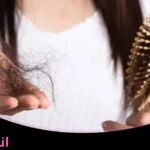 علاج تساقط الشعر الشديد عند النساء